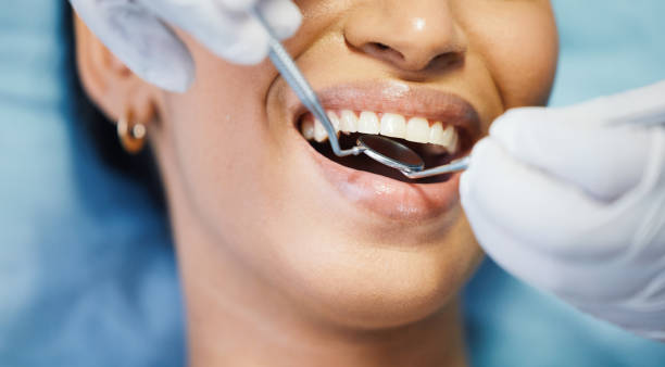 Best Emergency Broken Tooth Repair in Coopersburg, PA