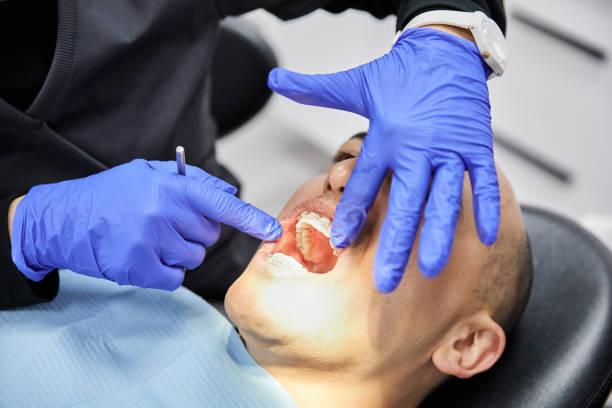 Best Emergency Tooth Extraction in Coopersburg, PA