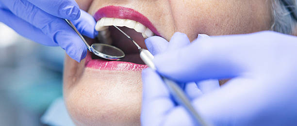 Best Emergency Tooth Extraction in Coopersburg, PA